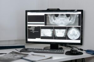 Manglaur Digital X-ray Center